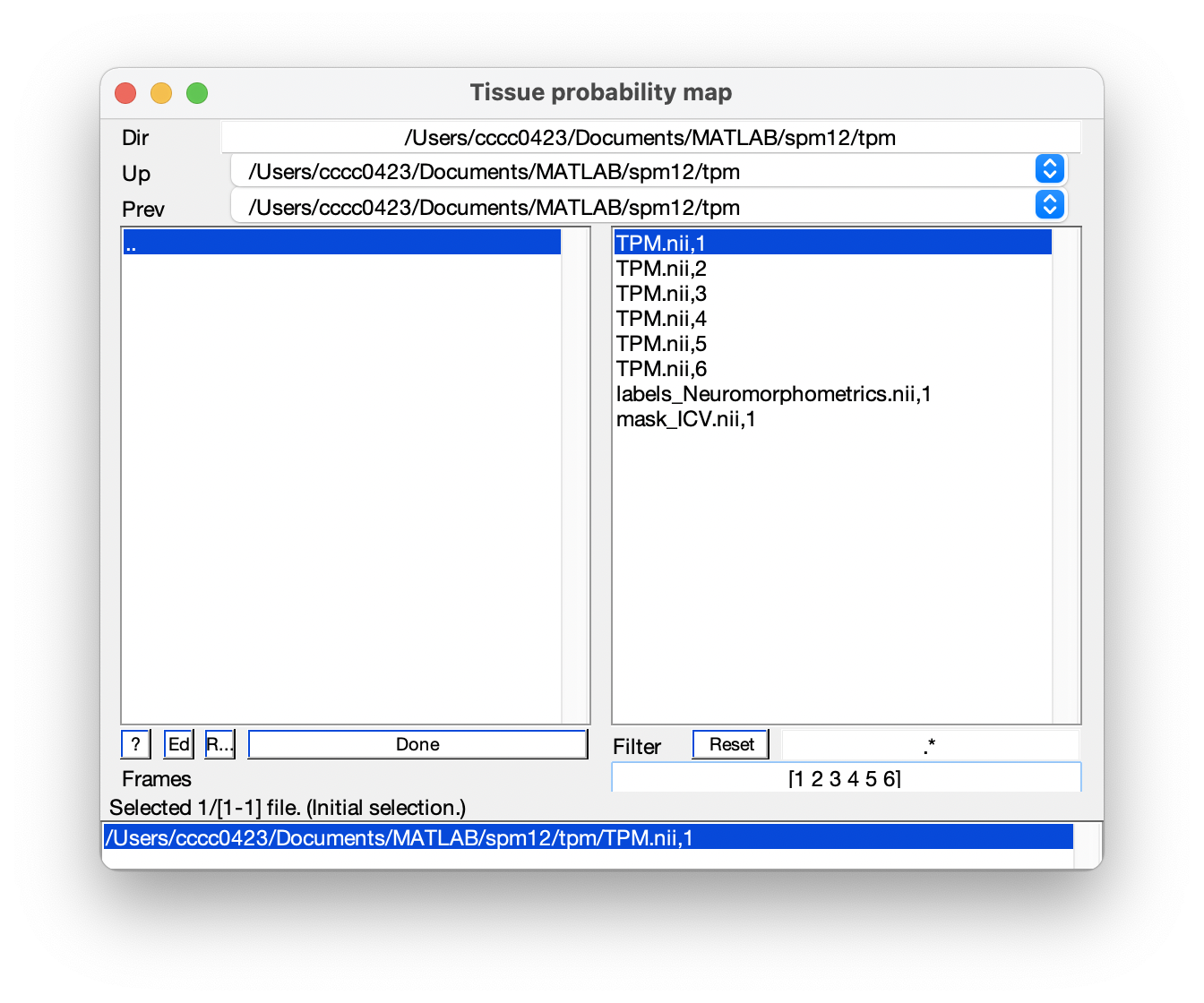 `Segment` 中的每個 `TPM.nii` 必須是依序的不同的六個 maps。