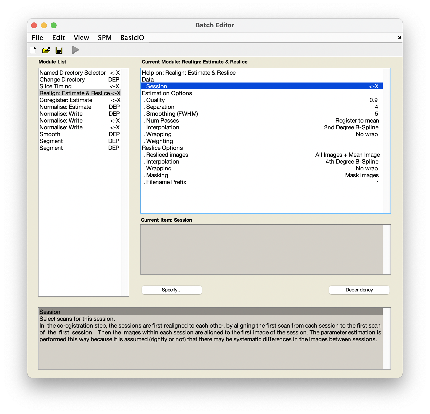 `Realign: Estimate & Reslice` 中的 `Session`。