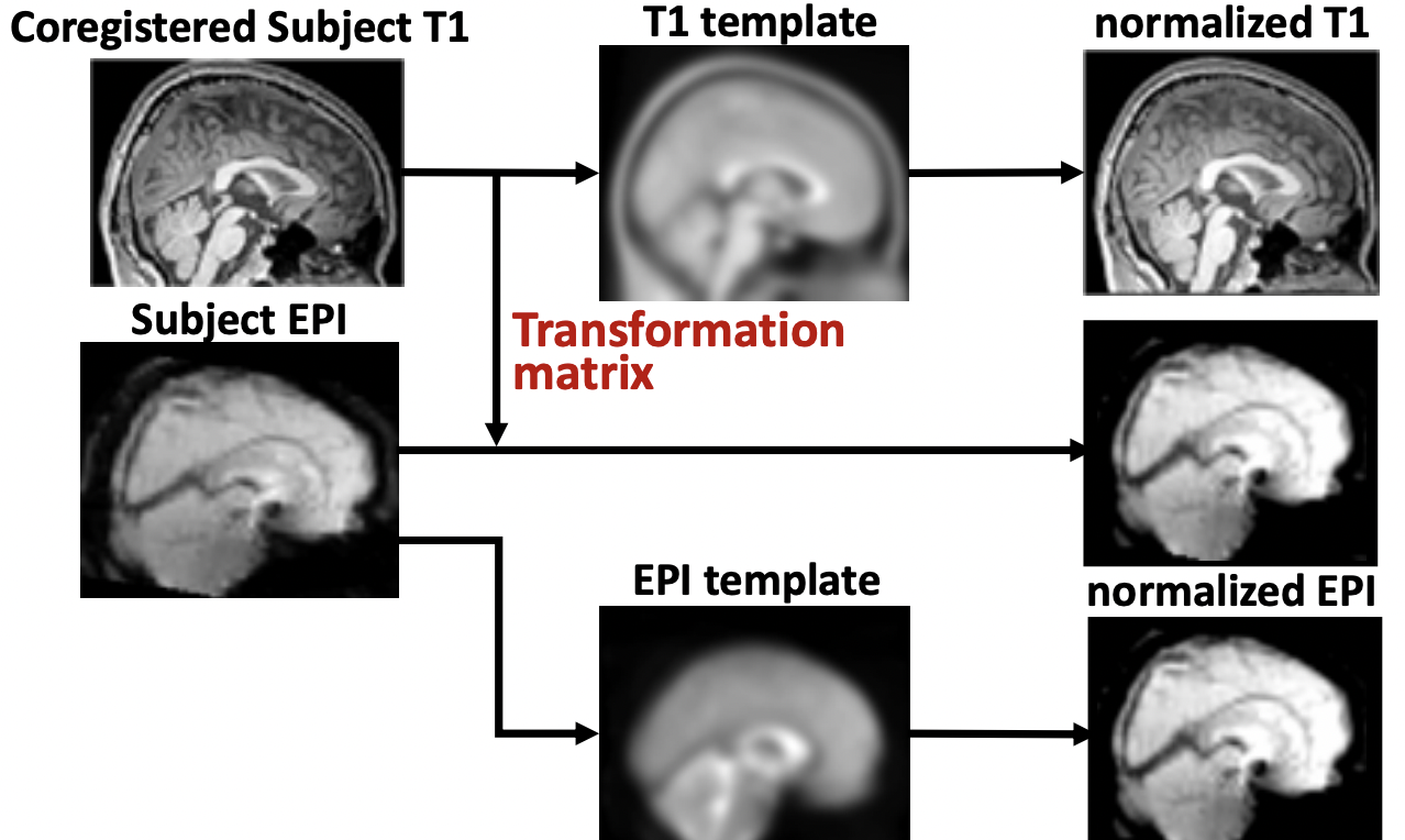 Spatial normalization 的途徑。