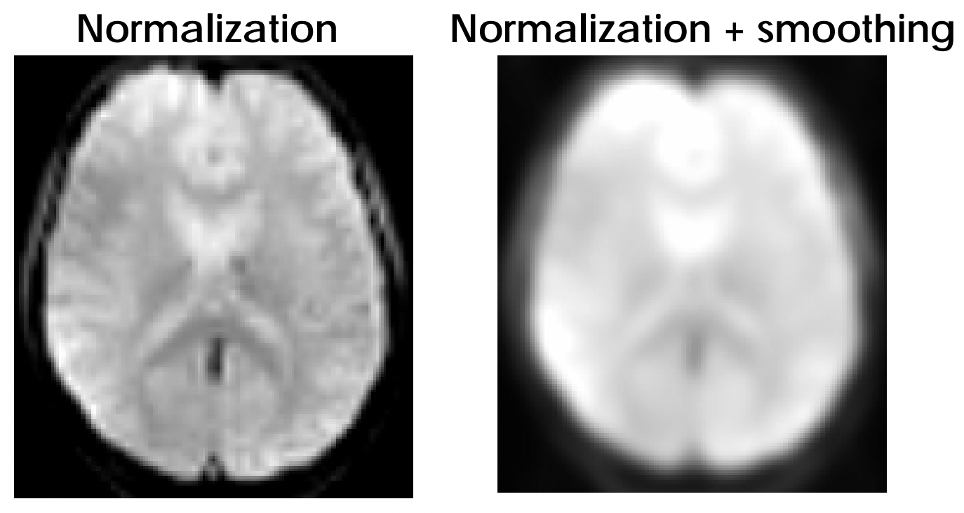 Gaussian spatial smoothing.