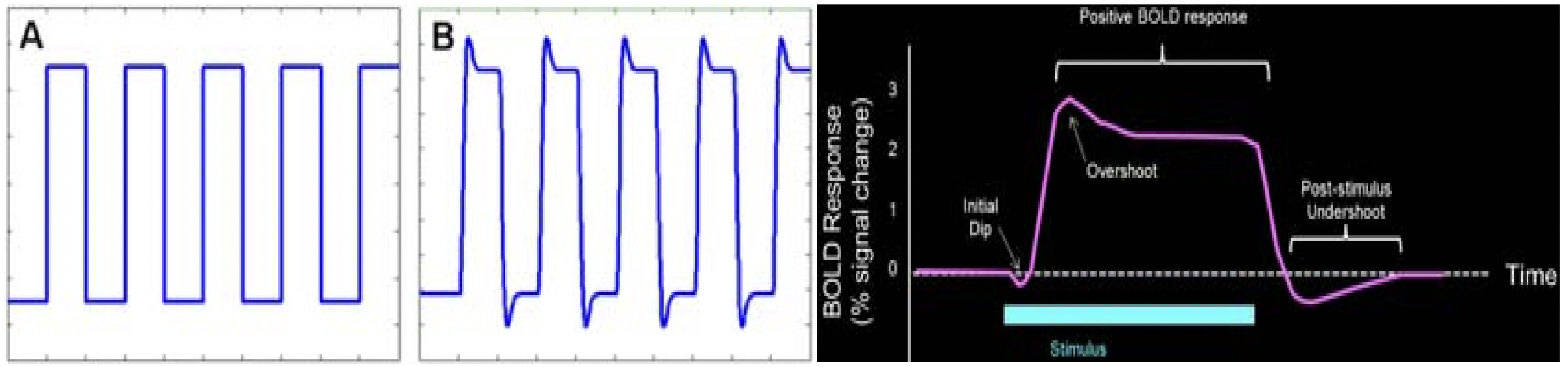 Block design. 圖源：Matthijs Vink, *Preprocessing and analysis of functional MRI data*, 2007.