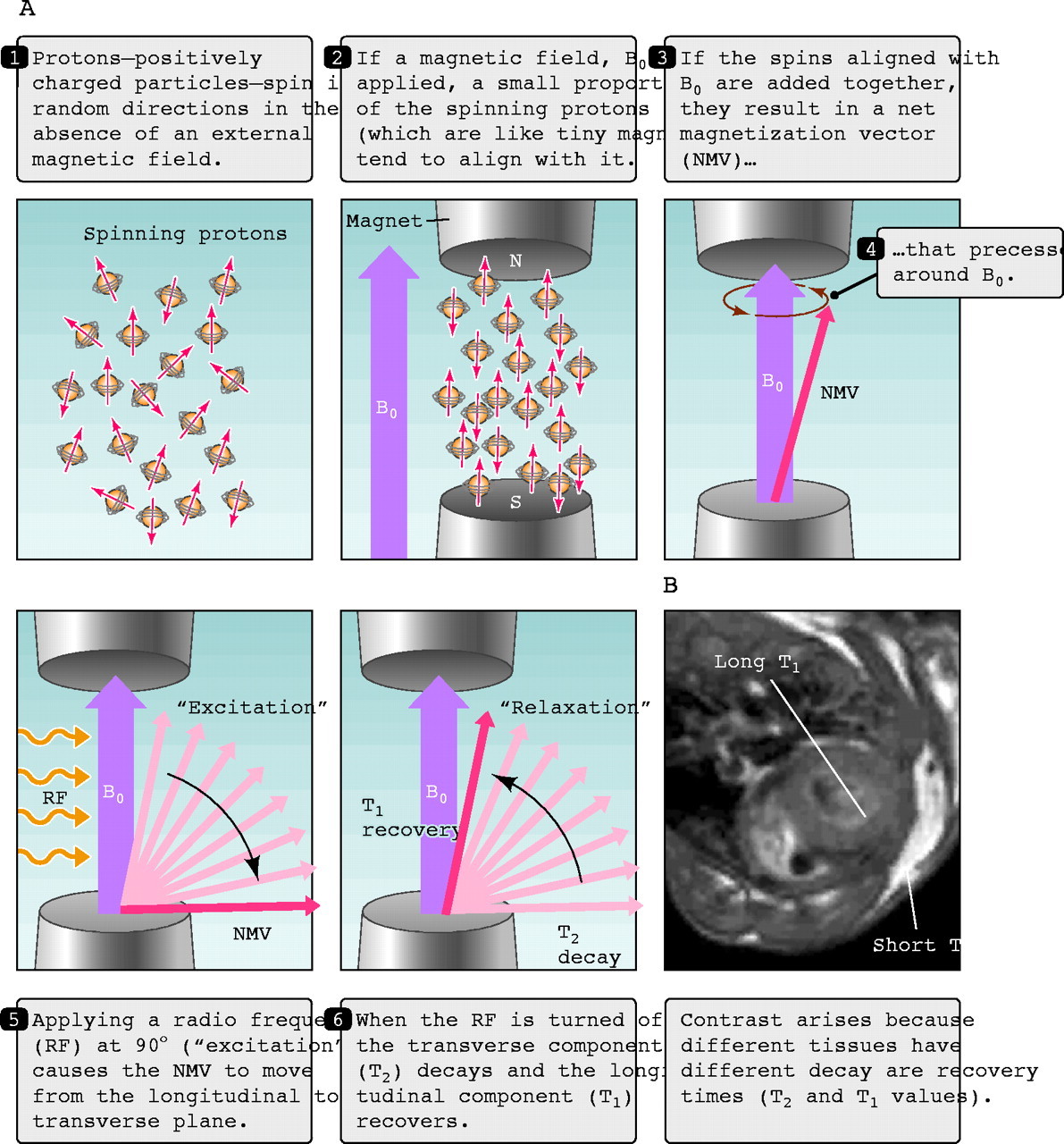 MRI 的運作原理。圖源：Pautler, R. G. (2004). Mouse MRI: concepts and applications in physiology. *Physiology, 19*(4), 168-175.