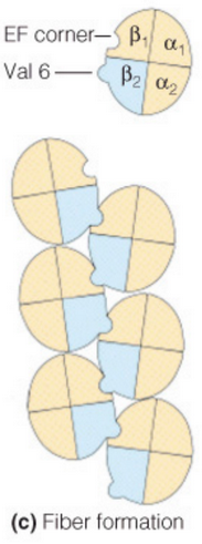 Schematic of Fibers Present in Sickle Cell Anemia