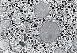 Glycogen Stores in a Hepatocyte