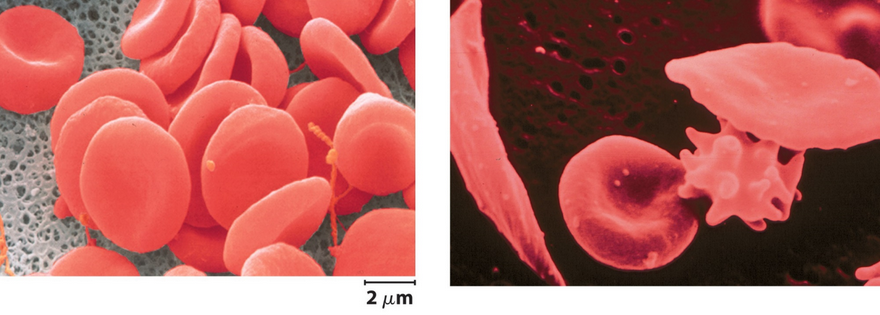 Mutant (right) and Healthy Hemoglobin (left)