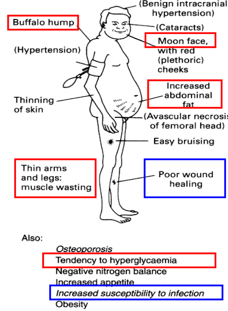 Cushing's Syndrome