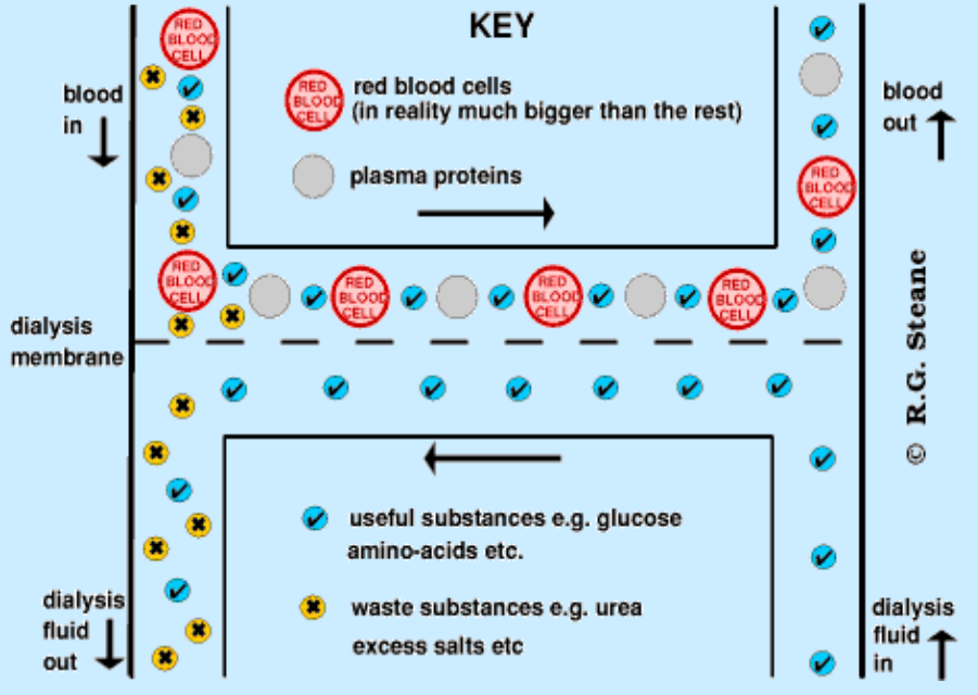 Dialysis Mechanism