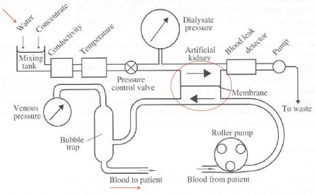 Hemodialysis Setup