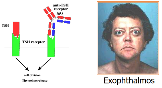 Somebody with Graves' Disease