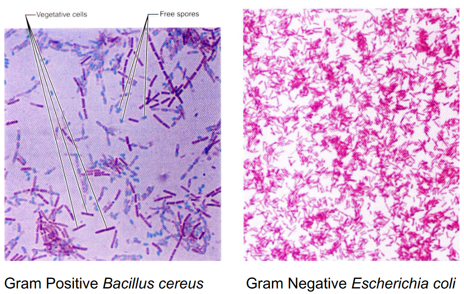 Gram Positive and Negative Bacterium