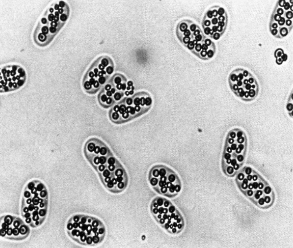 Sulfur Granules in C. buderi