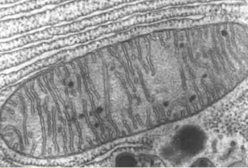 Electron Microscopy of a Mitochondrion