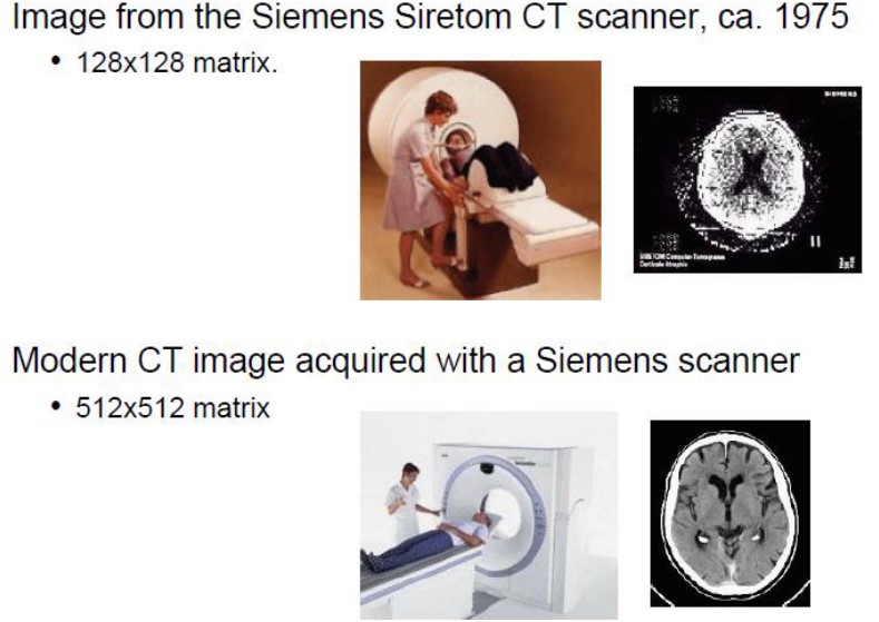 CT Scanners Over Time