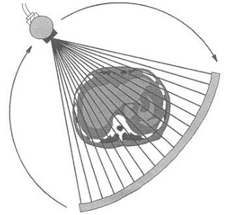 Illustration of a Wide Fan Beam