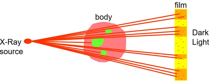 Illustration of how an X-Ray Film Works