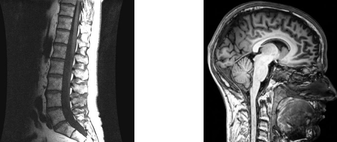 Sample MRI Images