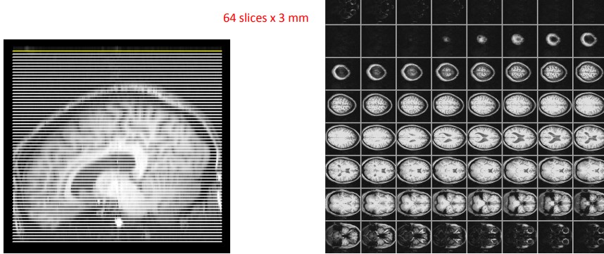 Stage 1 Anatomical Image Acquisition