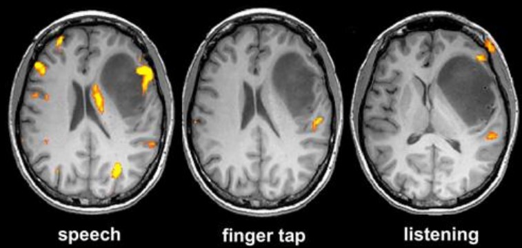 fMRI images depending on activity done