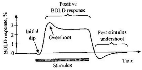 BOLD Response in a fMRI