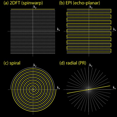 Trajectories in a fMRI Image Acquisition