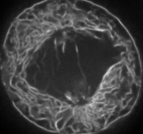 A Live HeLa Cell Visualized Using Confocal Microscopy