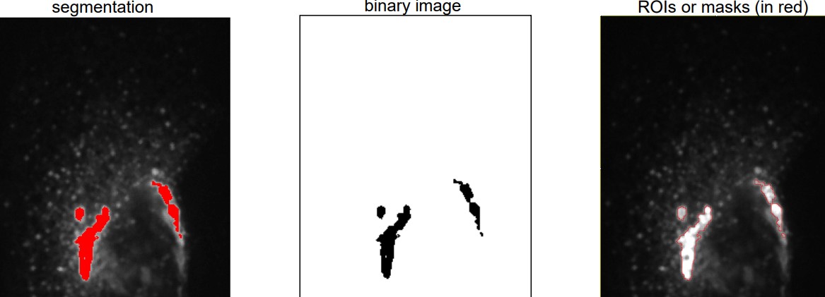 Region of Interest Visualization