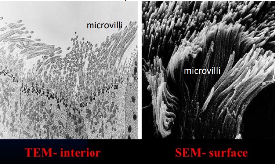 Epithelial Cells Viewed Using SEM and TEM