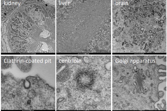 TEM View of Several Mouse Tissue Samples