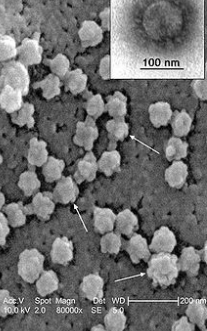 Electron Micrograph of SARS Virus