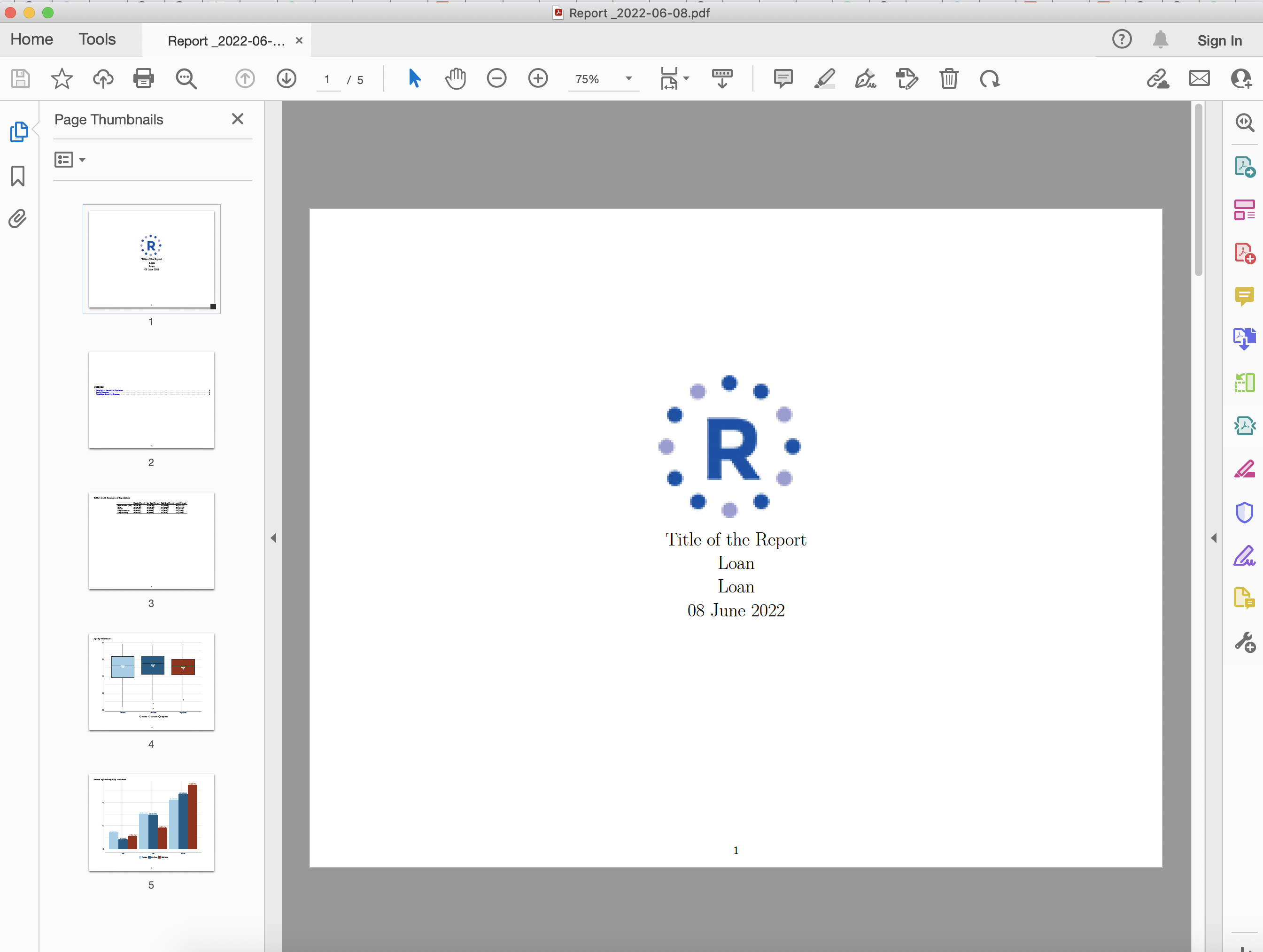  Tables - Interface UI 