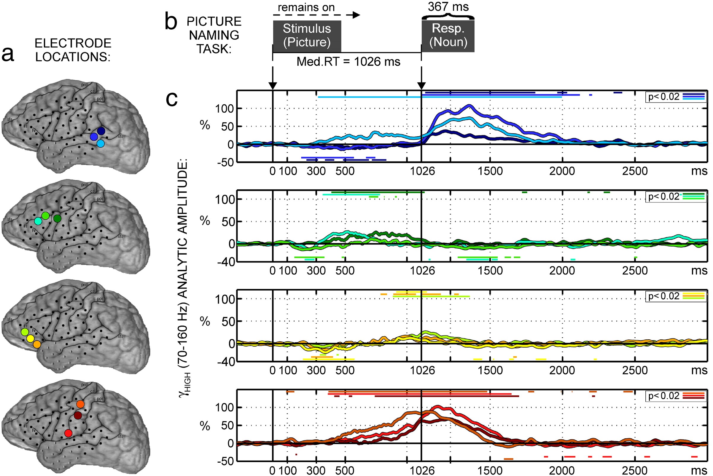 Activity during picture naming for one participant. a. Locations of the recording sites. The colours correspond to the signal time courses in c. b. Trial events (stimulus and response). c. Activity time courses. Vertical lines indicate stimulus onset and median response onset. Coloured horizontal lines indicate periods of significant amplitude change relative to the pre-stimulus baseline. Modified from the original (i.e., panels removed). Reprinted from NeuroImage, 50/1, Edwards, E., Nagarajan, S. S., Dalal, S. S., Canolty, R. T., Kirsch, H. E., Barbaro, N. M., & Knight, R. T. “Spatiotemporal imaging of cortical activation during verb generation and picture naming”, 291-301, Copyright (2010), with permission from Elsevier.