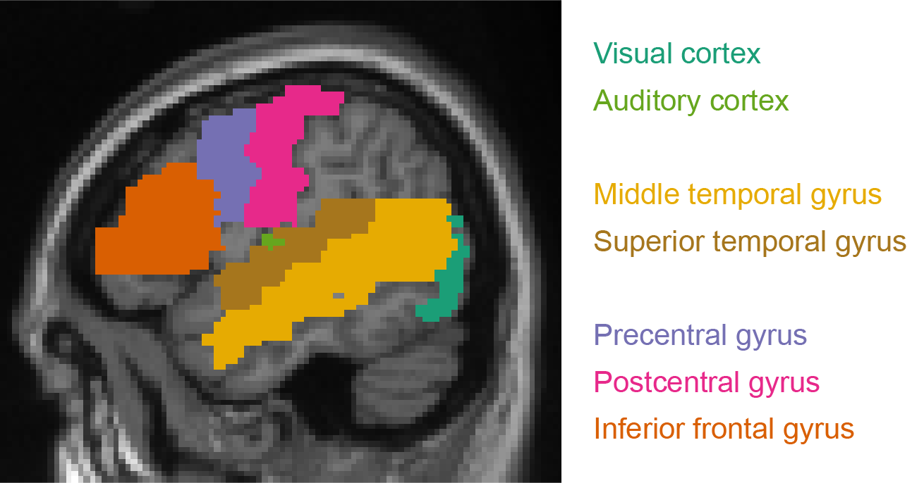 Anatomical regions relevant for language production.